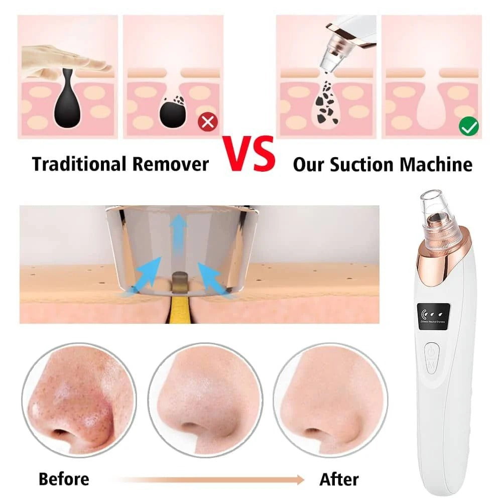 Electric Blackhead Remover Vacuum Pore Cleaner #2011